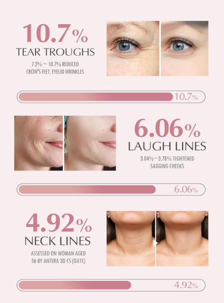 KAHI Wrinkle Bounce Multi Balm Stick | PDRN Collagen Wrinkle Stick | Korean Skin Care |All-in-One Hydrating Lip Balm Eye Cream Neck Cream Make Up Base & Face Mist Moisture Balm